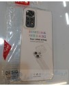 گارد شفاف محافظ دوربین شرکتی گوشی شیائومی مدل redmi note 11 /11s - ضربه گیر